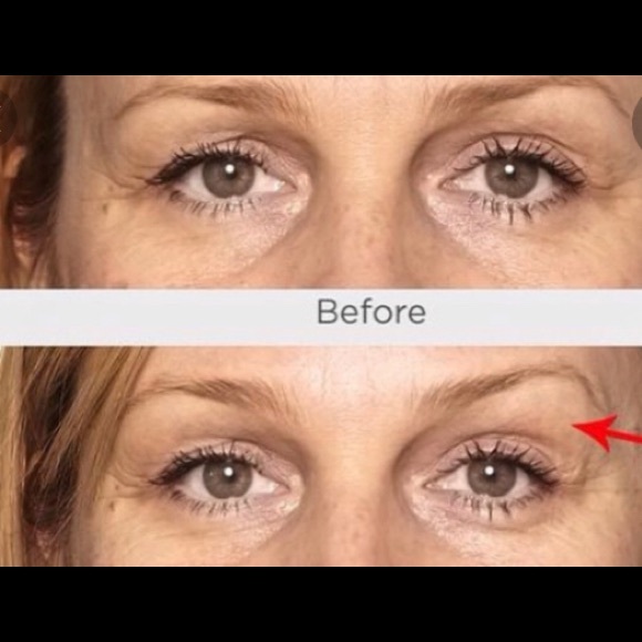 isdin eye cream